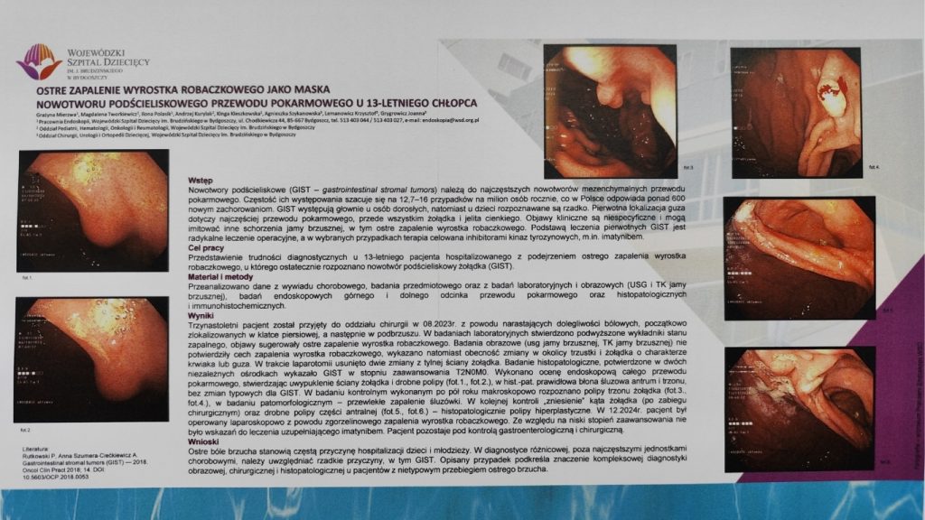 Plakat „Ostre zapalenie wyrostka robaczkowego jako maska nowotworu podścieliskowego przewodu pokarmowego u 13-letniego chłopca”