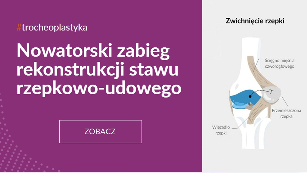 Schemat graficzny – przemieszczona rzepka – dowiedz się więcej o zabiegu rekonstrukcji stawu rzepkowo-biodrowego